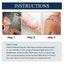 Psoriasis Relief Spray, Relieve Skin, Hands And Feet Redness Peeling Itch Repair External Care - Korvel