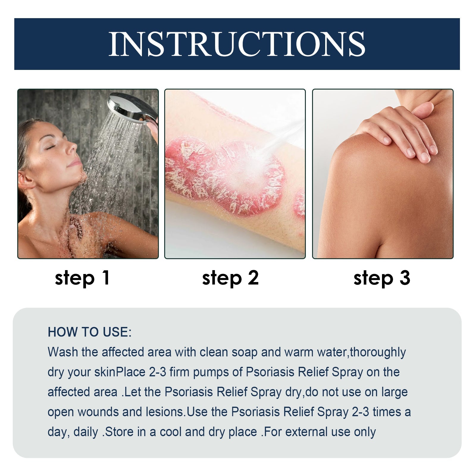 Psoriasis Relief Spray, Relieve Skin, Hands And Feet Redness Peeling Itch Repair External Care - Korvel
