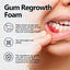 oralhoe Gum Regrowth Foam, Clean Teeth Tartar Care Gums Clean Teeth Anti-Moth Fresh Breath Mousse - Korvel