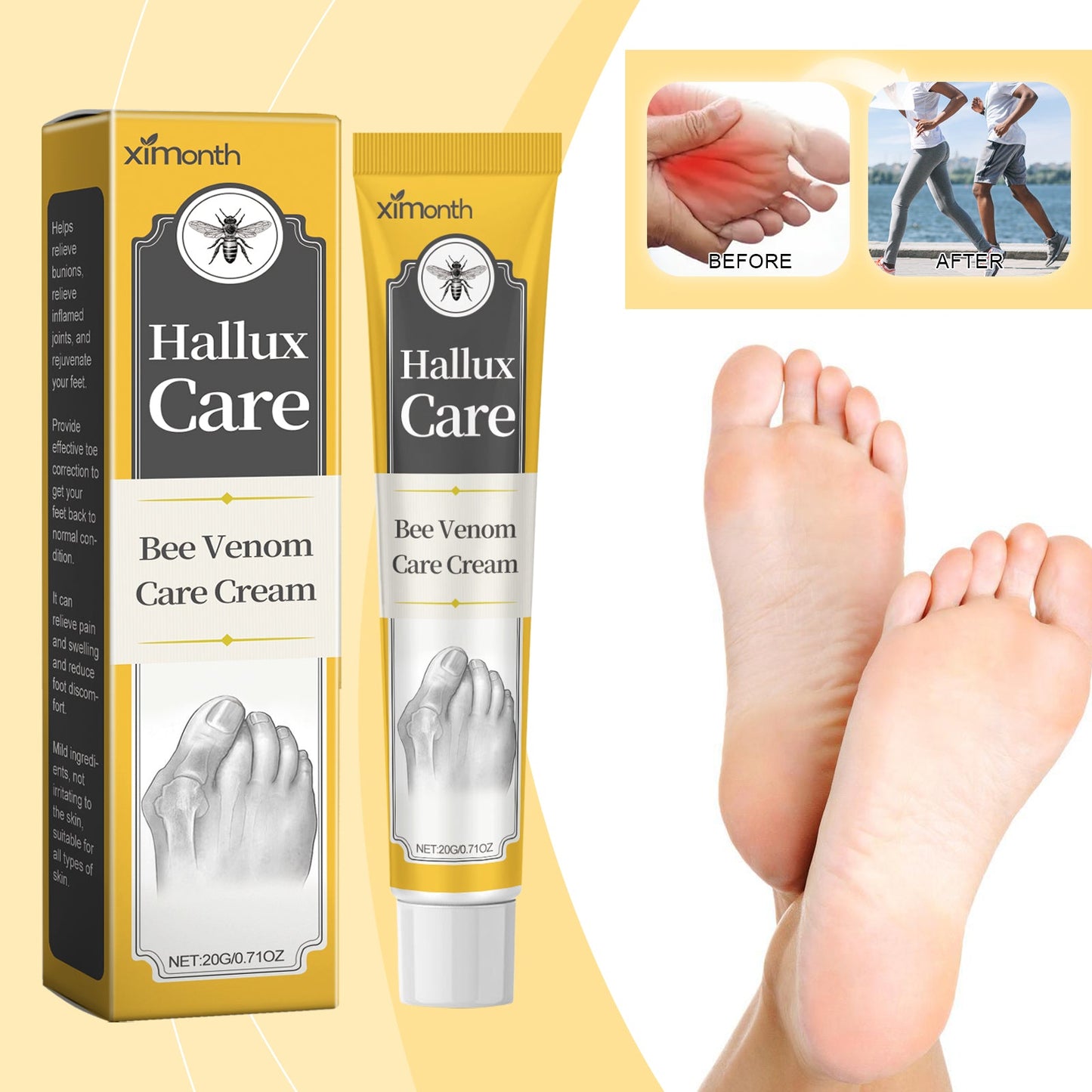 Bee Venom Care Cream, Bee Venom Care Cream To Relieve Inflammation, Pain Swelling Can Improve Joint Health Bunions Adjuvant Therapy - Korvel