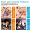 Premium Pet Dental Cleaning Finger Set for Dogs and Cats