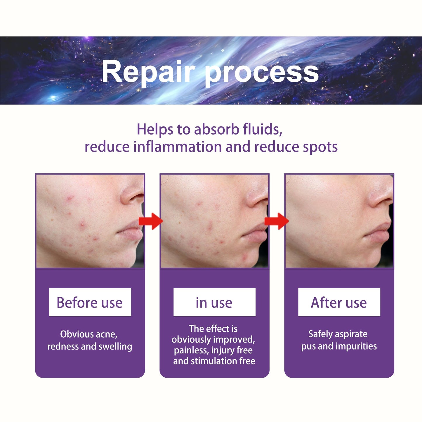 Acne Patch, Fade Closed Mouth Acne, Clear Acne, Waterproof Breathable Repair Acne Muscle Pattern Acne Patch - Korvel