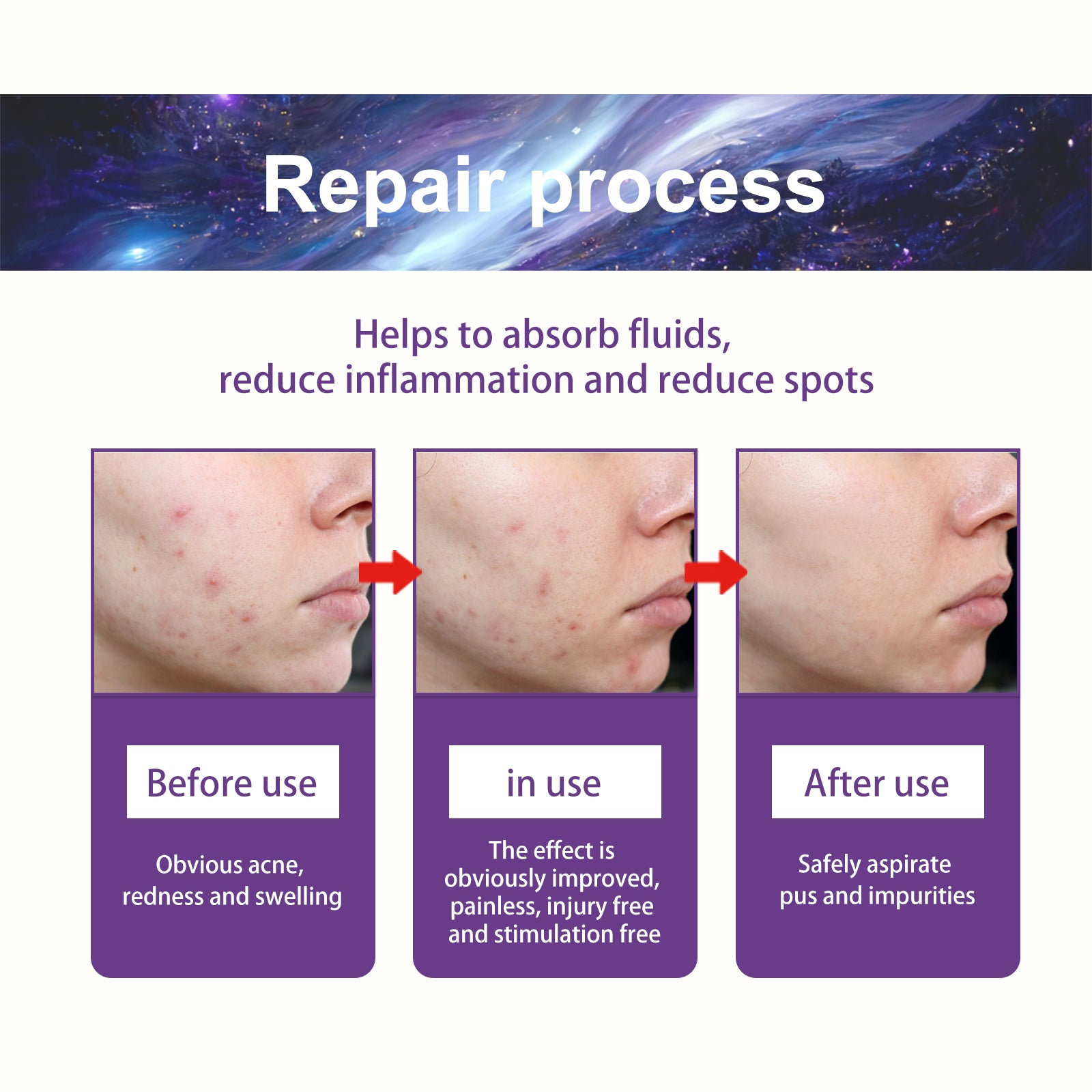 Acne Patch, Fade Closed Mouth Acne, Clear Acne, Waterproof Breathable Repair Acne Muscle Pattern Acne Patch - Korvel