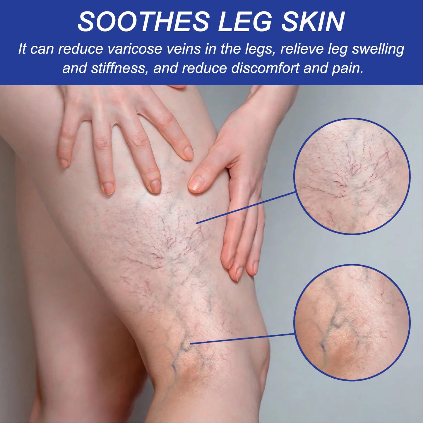 Spray de confort veineux pour les douleurs et gonflements des jambes