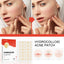 Invisible Hydrocolloid Acne Patches for Clear Skin