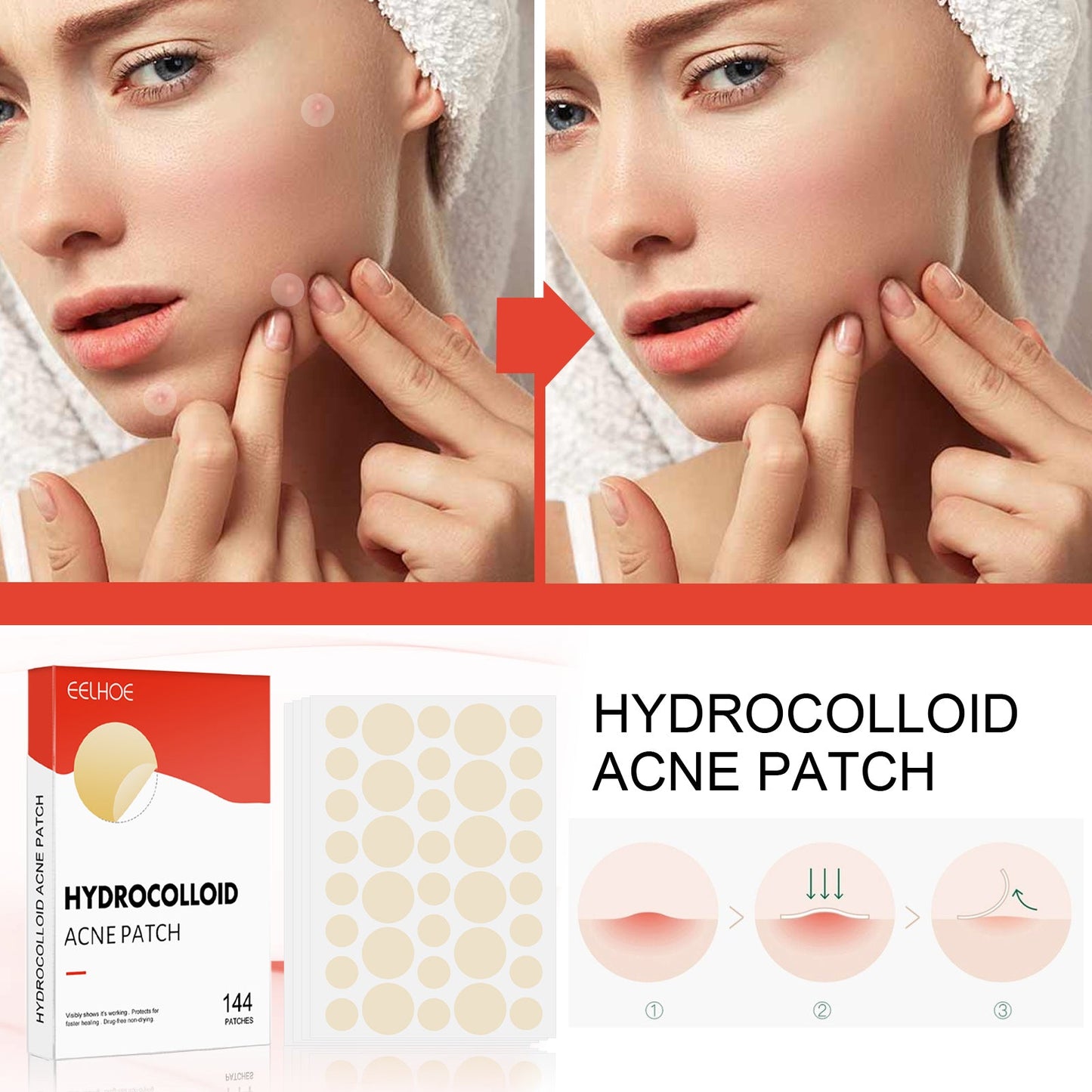 Invisible Hydrocolloid Acne Patches for Clear Skin