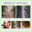 Hair Care Conditioner Scalp Root Care Care Nourishes Hair Follicles Hair Shine Conditioner - Korvel