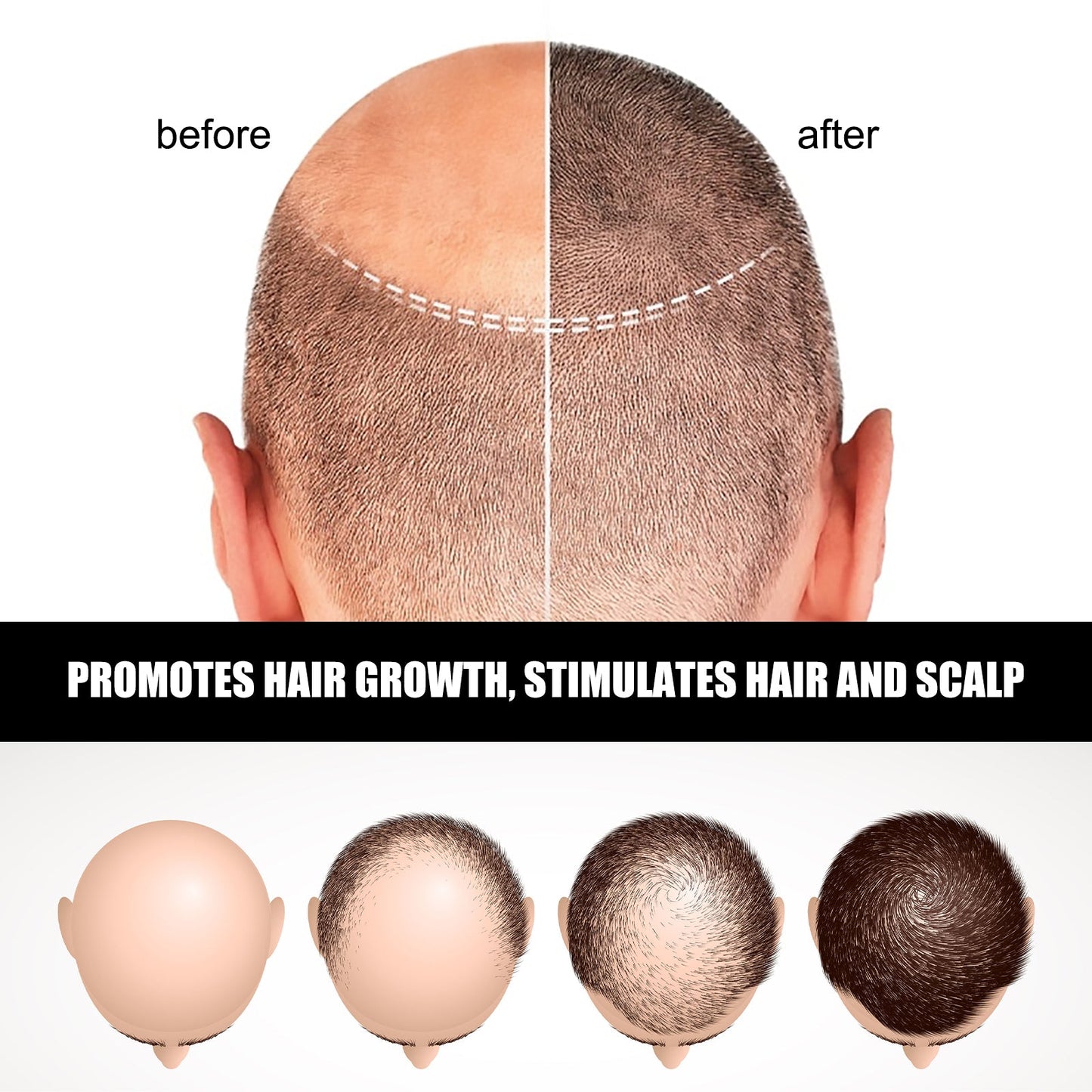 Suero de Ampolla para el Cabello Premium para Nutrir y Fortalecer