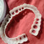 Braces de dentier premium pour un sourire confiant