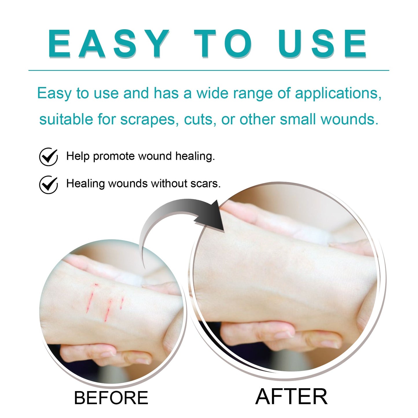 Liquid Bandage Drops - Fast-Acting Skin Protection