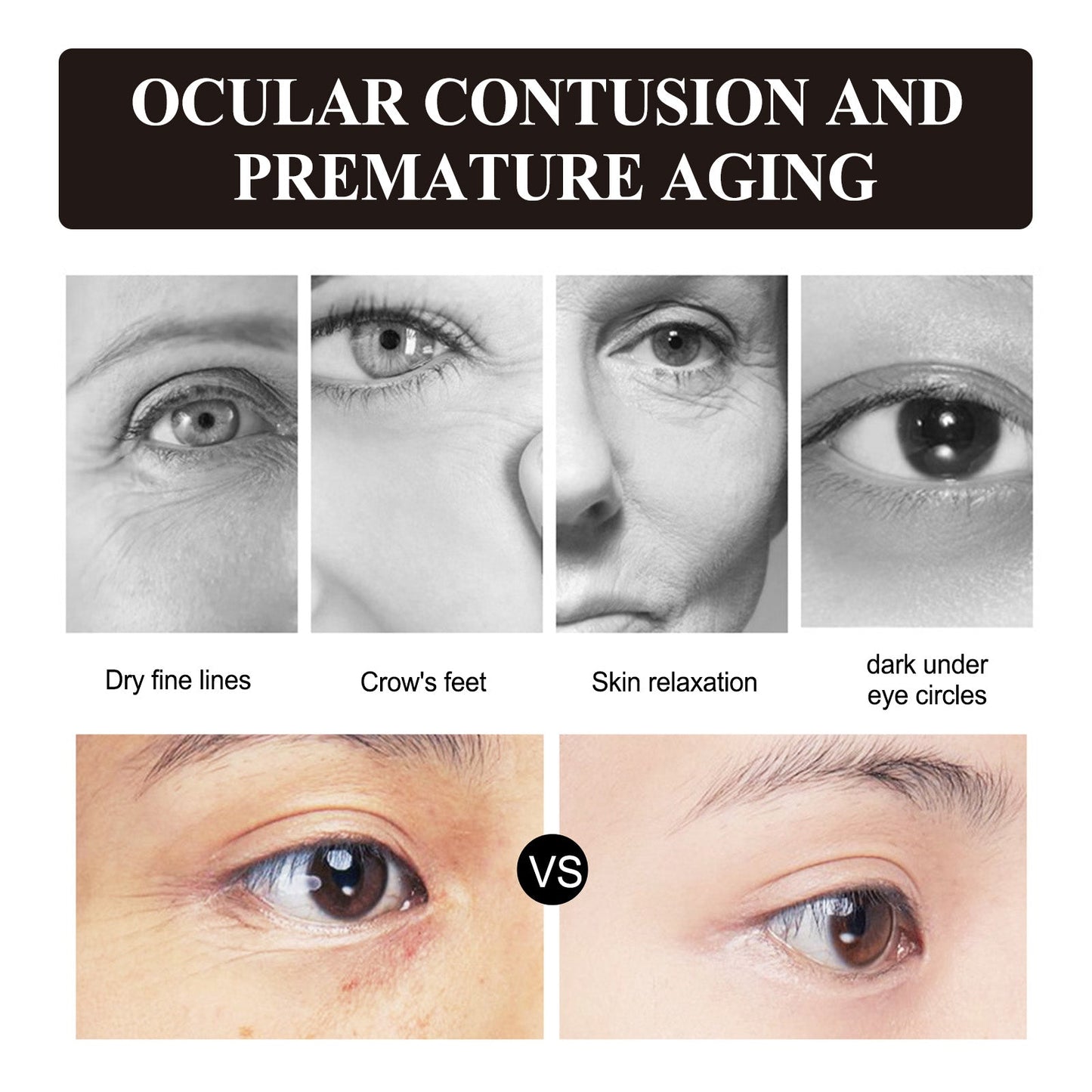 Retinol Eye Cream, Desalination Smoothen Fine Lines Eye Pouch Black Rim Of The Eye Moist Nursing Play Tight Muscle Eye Cream - Korvel