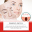 Morning And Evening Acne Covering Patch Facial Skin Acne Covering Relief Care Skin Acne Muscle - Korvel