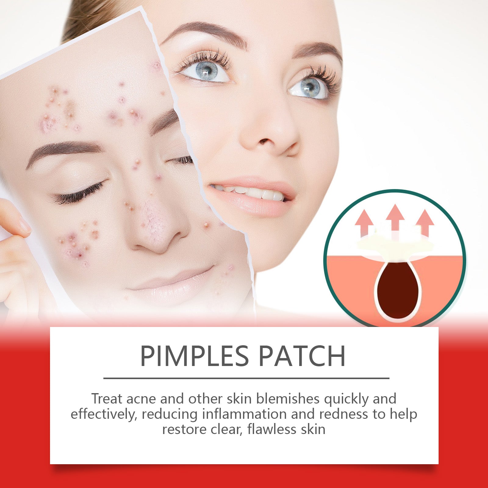 Morning And Evening Acne Covering Patch Facial Skin Acne Covering Relief Care Skin Acne Muscle - Korvel