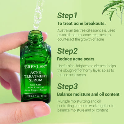 BREYLEE Acne Treatment Face Serum Mask Anti Acne Pimple Scar Remover Moisturizing Whitening Skin Care Facial Essence Cream 17ml - Korvel