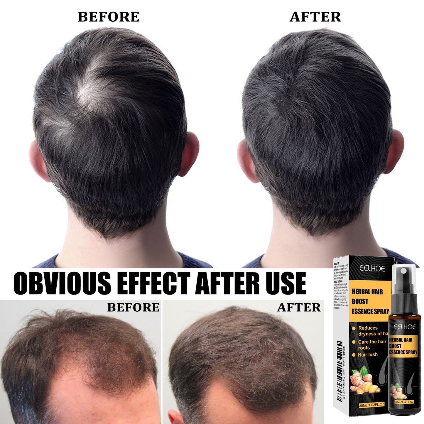 Herbal Hair Essence Spray,Prevent Falling Hair And Scalp Moisturizing And Nourishing Solution - Korvel