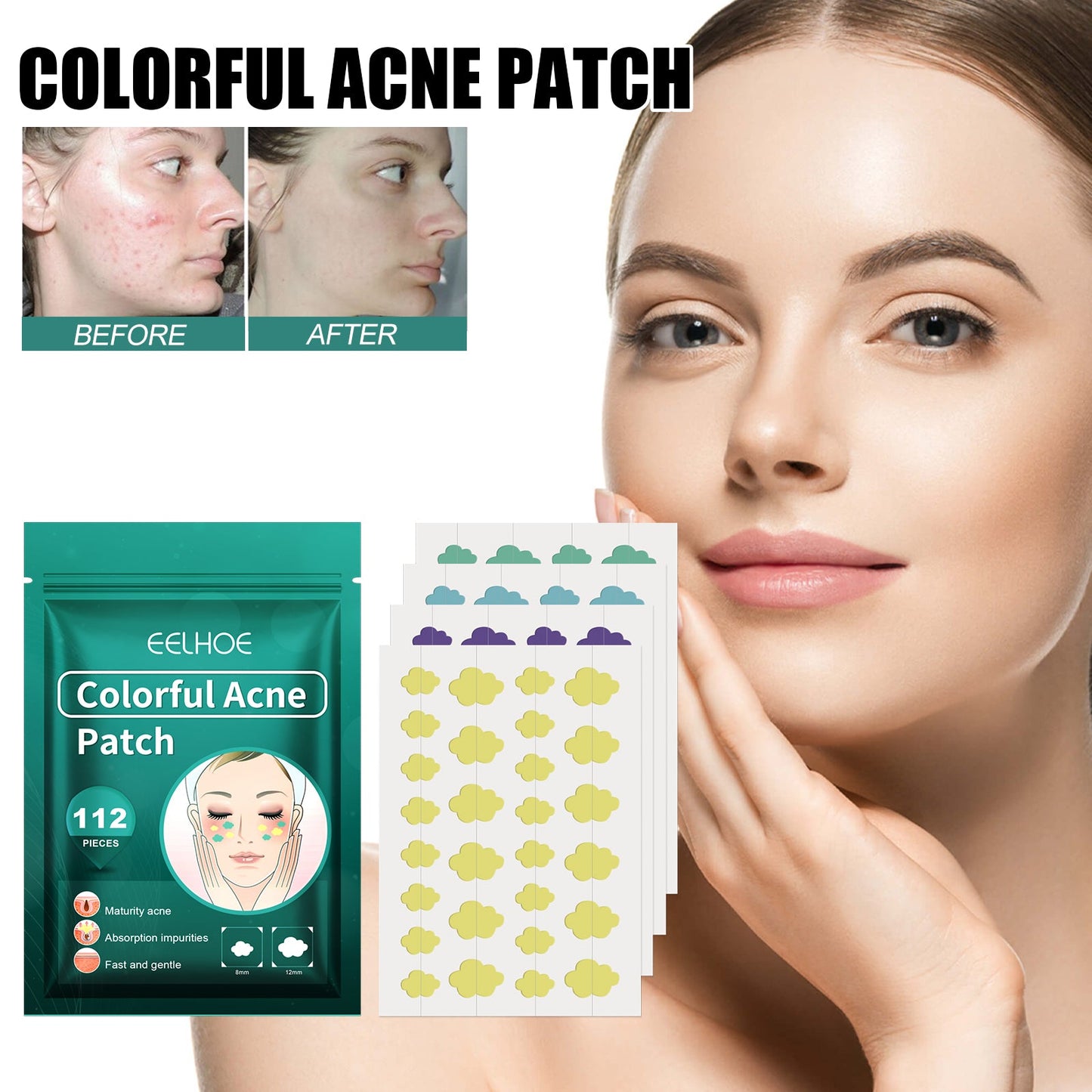 Colorful Acne Patch, Repair Pit Acne Print Smooth Skin Lightening Spot Clear Acne Facial - Korvel
