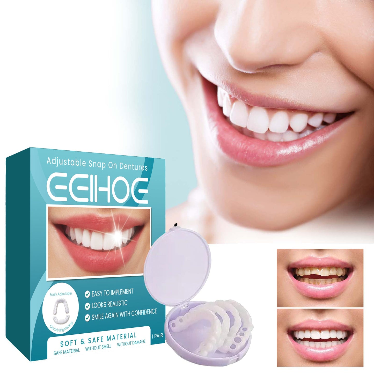 Adjustable Buckle Denture Kit for Comfort and Fit