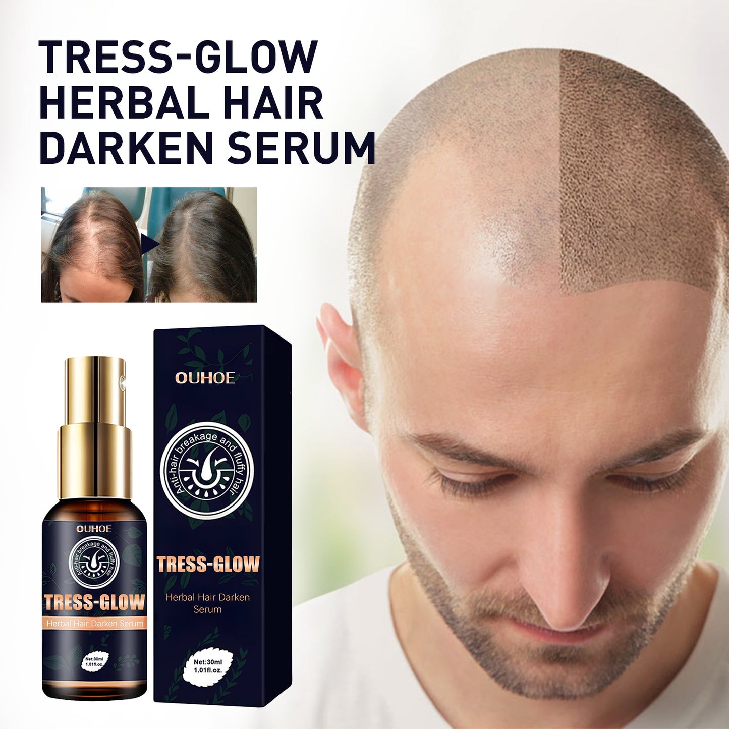 Herbal Hair Essence, Moisturizes Scalp Strong Hair Roots Thick Beard Care Essence - Korvel