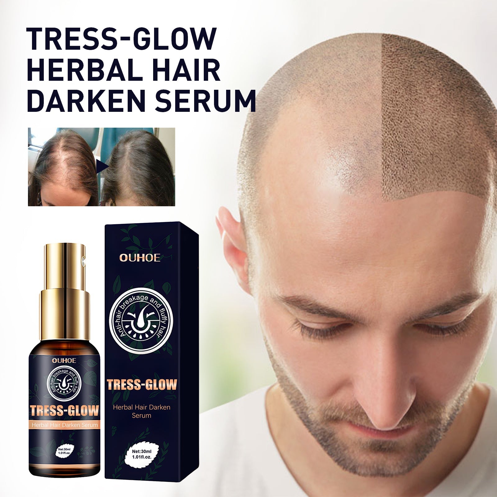 Herbal Hair Essence, Moisturizes Scalp Strong Hair Roots Thick Beard Care Essence - Korvel