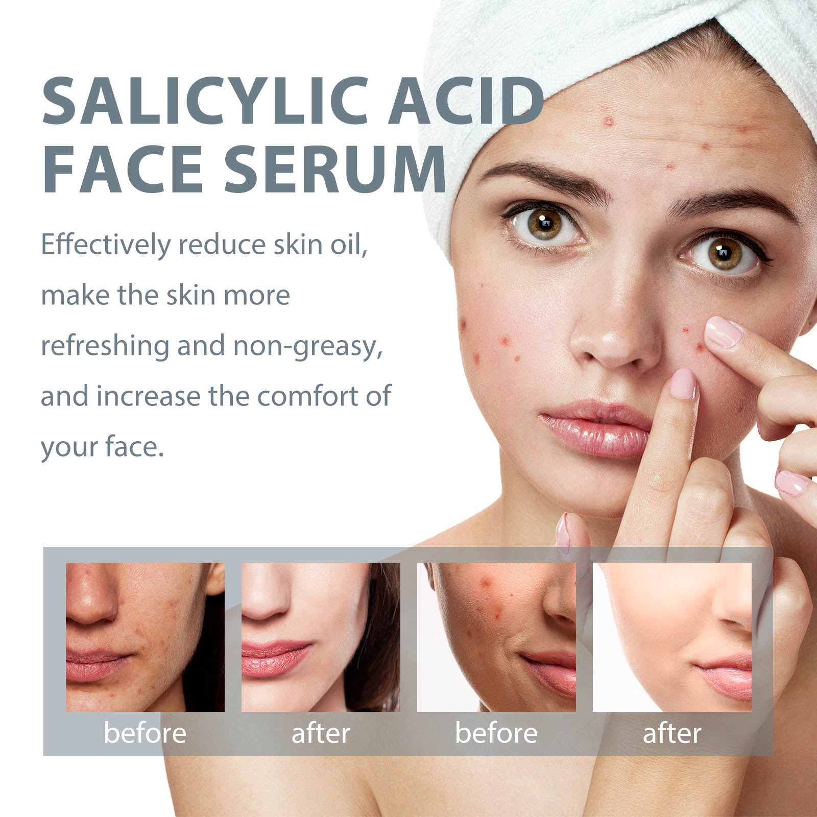Salicylic Acid Facial Essence, Lighten Acne Mark Repair Hydrating Facial Care Essence - Korvel