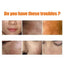 Turmeric Skin Care Series Deeply Cleans And Repairs Skin Barrier, Hydrates And Moisturizes White And Supple Skin - Korvel