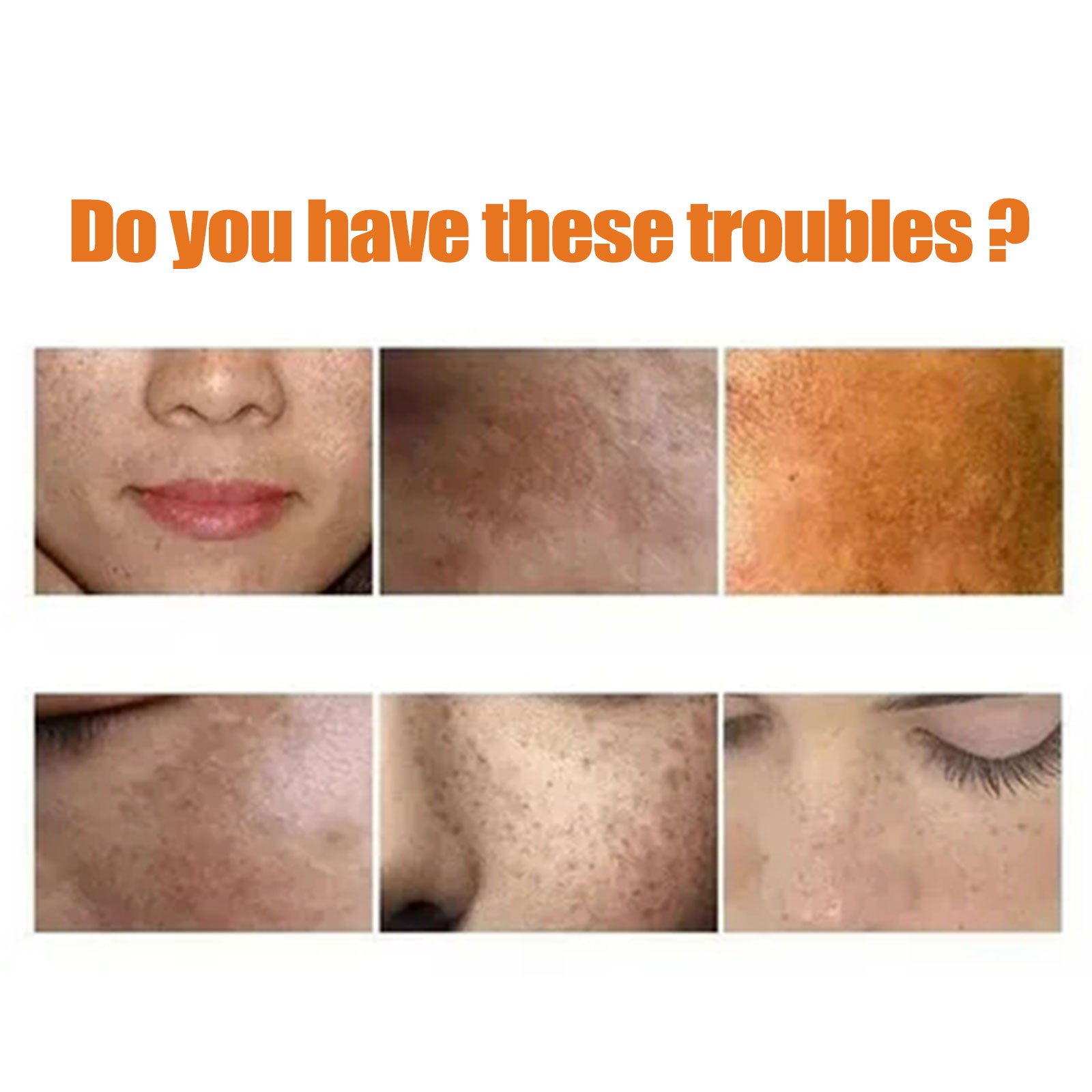 Turmeric Skin Care Series Deeply Cleans And Repairs Skin Barrier, Hydrates And Moisturizes White And Supple Skin - Korvel