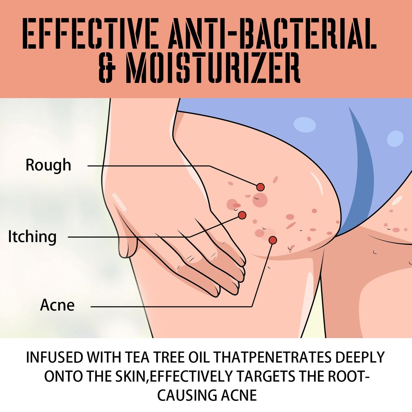 Buttock Care Cream, Repair Rough Buttock Skin Gentle Care Moisturizing And Moisturizing Skin - Korvel