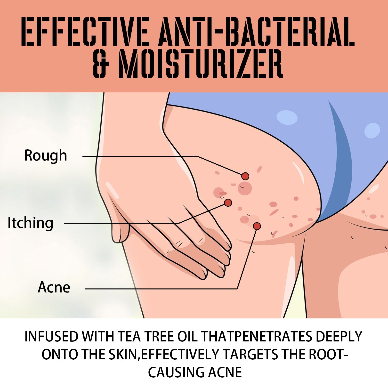 Buttock Care Cream, Repair Rough Buttock Skin Gentle Care Moisturizing And Moisturizing Skin - Korvel