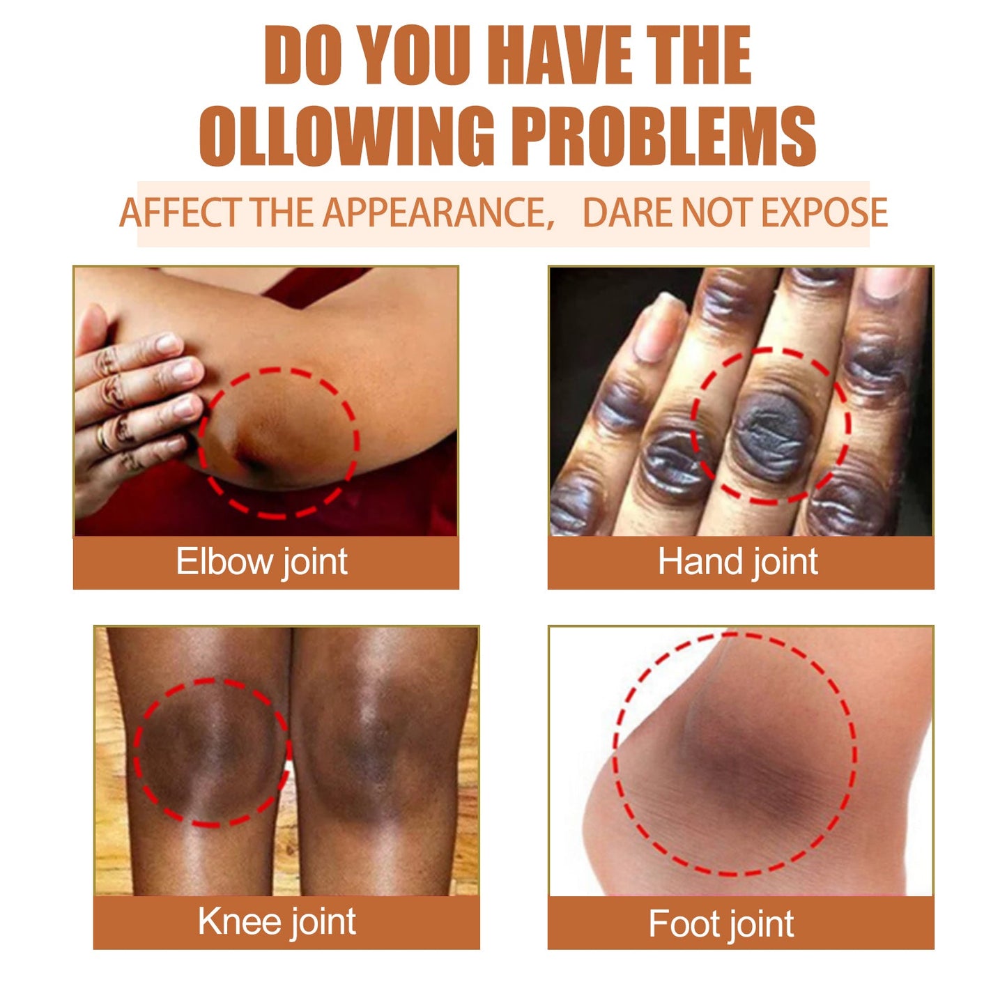 Papaya Seed Skin Care Oil Lightening Dark Spots, Bending Joints, Elbows, Brightening Skin And Moisturizing Oil - Korvel