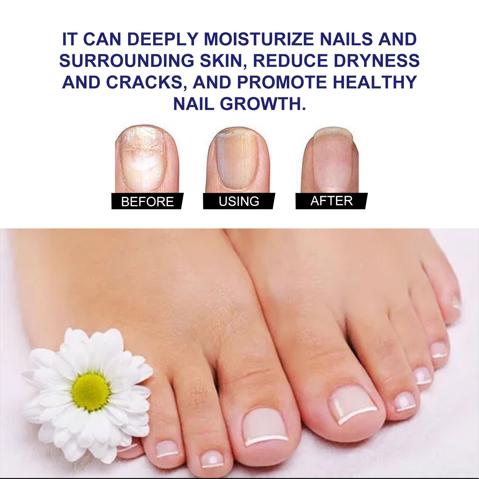 Plant Drops, Repair Extremities Soft Thickening Light Armour Moist Clean Fingernails Detailer - Korvel