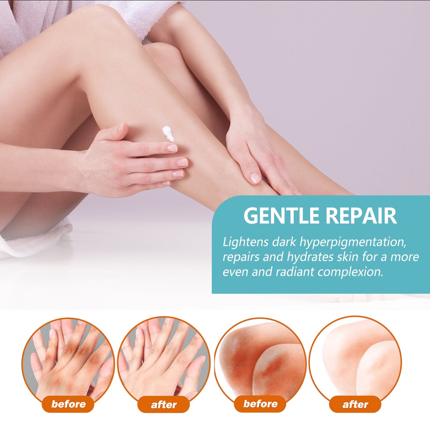 Black Acanthoderm Repair Cream Repair Underarm Arm Knee Joint Black Moisturizing Whitening Body Care Cream - Korvel