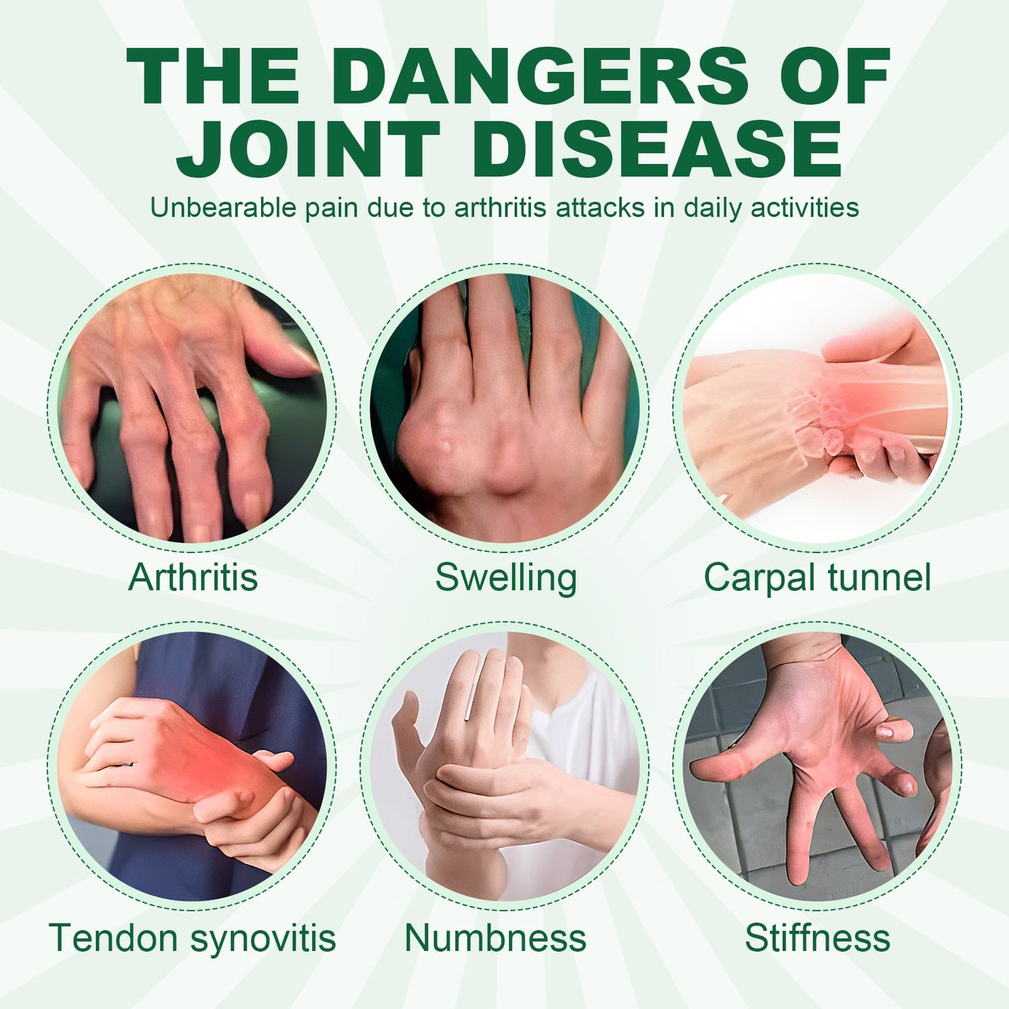 Joint Care Gloves Relieve Thumb Stiffness And Finger Joint Soreness And Swelling Discomfort Care Gloves - Korvel