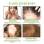 Ginger Care Shampoo Scalp Cleansing, Anti-Break Nourishing Root Strengthening Shampoo - Korvel