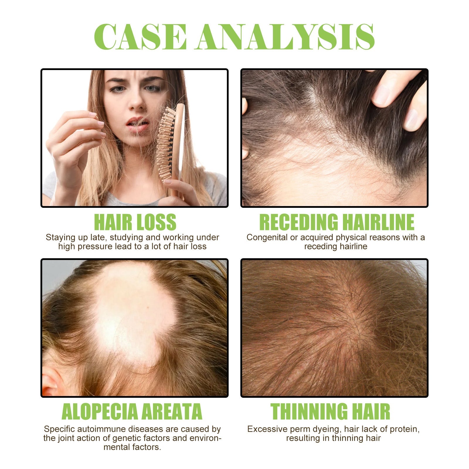 Ginger Care Shampoo Scalp Cleansing, Anti-Break Nourishing Root Strengthening Shampoo - Korvel