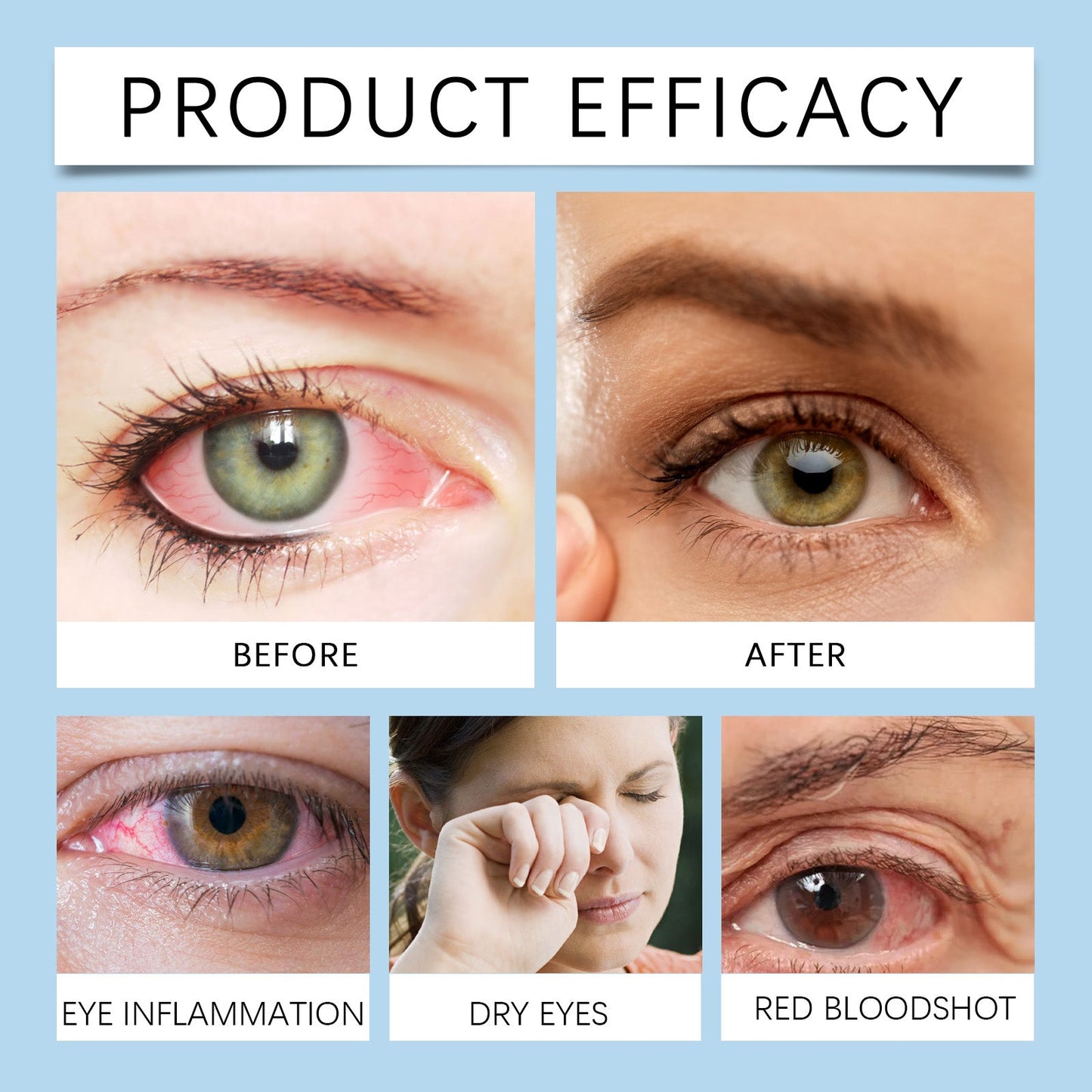 Gotas Hidratantes para los Ojos Premium para Comodidad y Cuidado