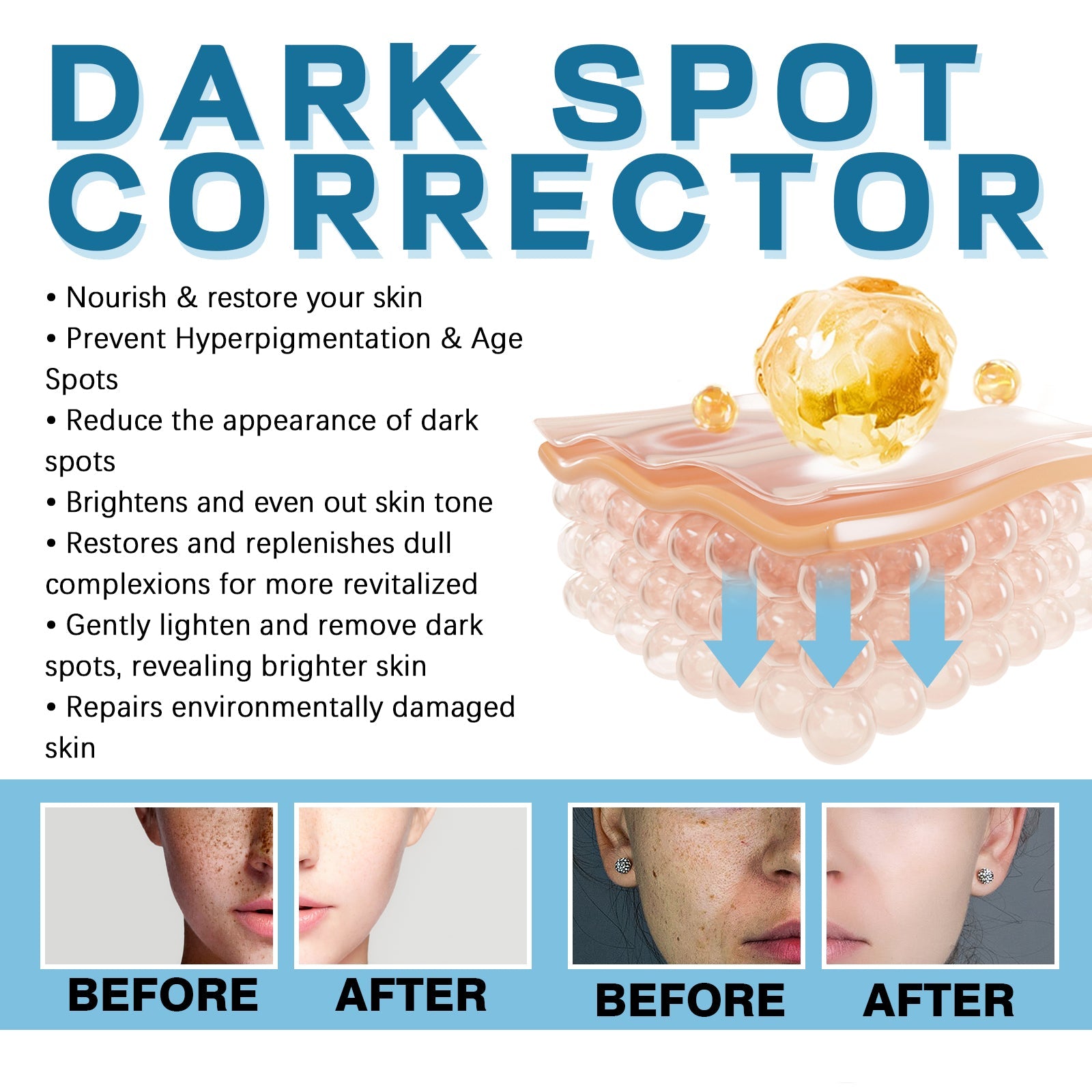 Dark Spot Lightening Cream Lightening Dark Spot Melasma Repairing Dull And Even Skin Tone Brightening Cream - Korvel