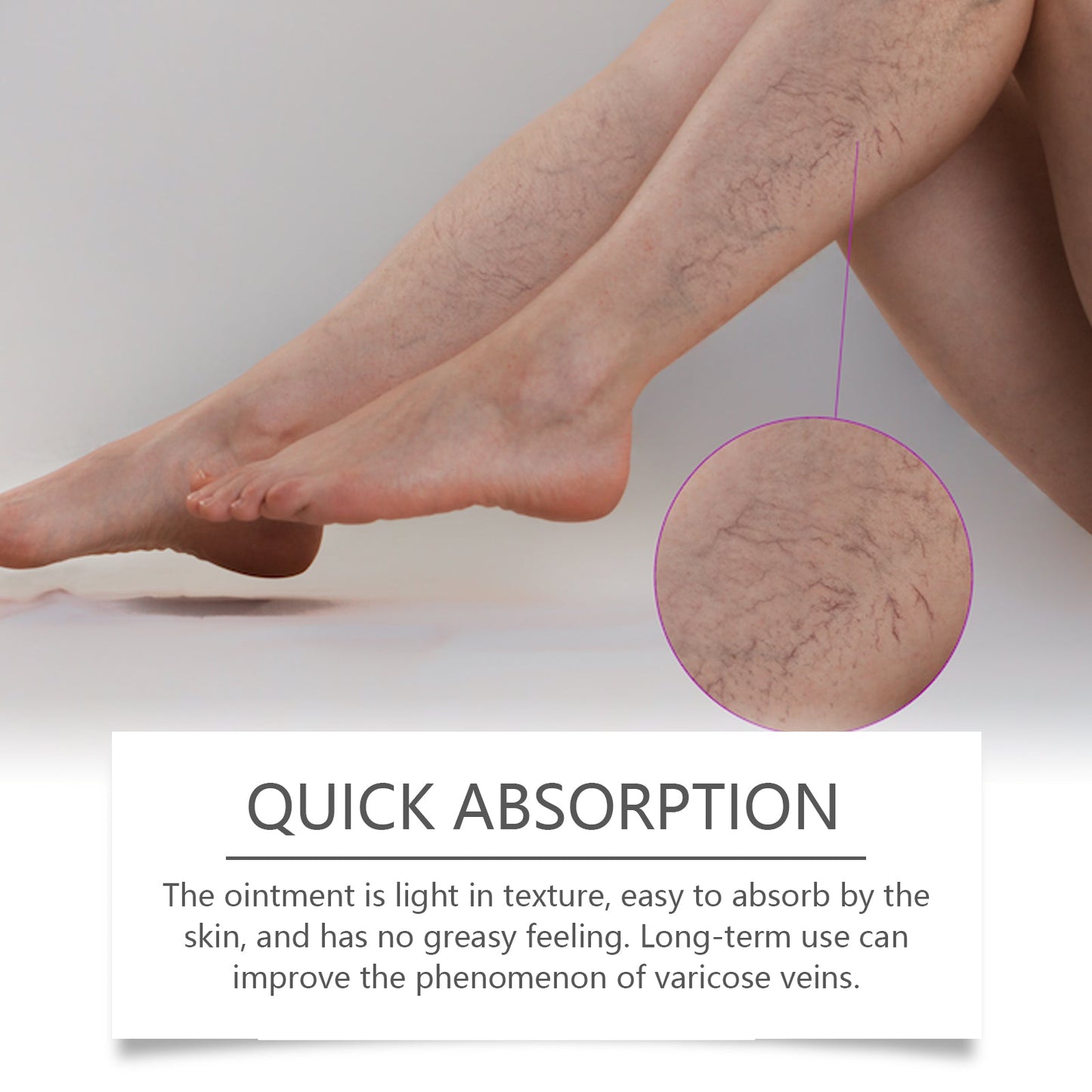 Herbal Leg Care Cream, Pamper, Massage, Repair And Relieve Uncomfortable Legs - Korvel