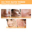 Glycolic Acid 7% Toner, Remove Acne Lighten Acne Repair Acne Mark Moisturize Skin Toner - Korvel