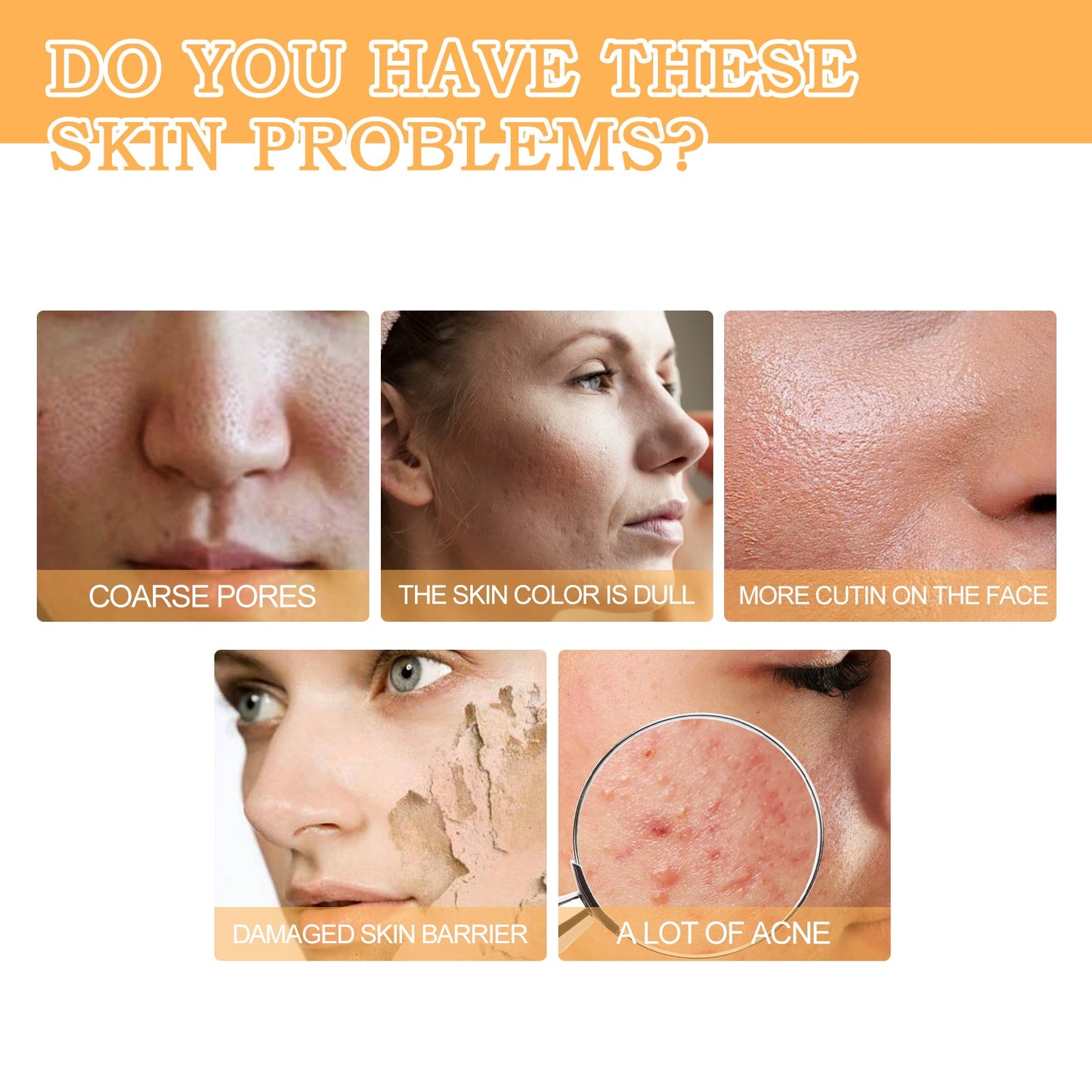 Glycolic Acid 7% Toner, Remove Acne Lighten Acne Repair Acne Mark Moisturize Skin Toner - Korvel