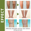 Crema Premium para Terapia de Venas para el Cuidado de las Piernas