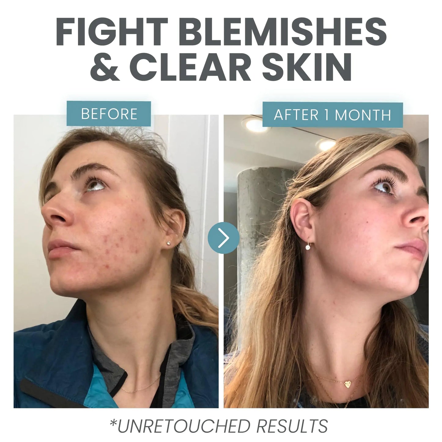 Premium Vitamin C Face Serum with Niacinamide & Hyaluronic Acid