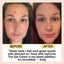 Eye Cream with Hyaluronic Acid & Coffee - Korvel