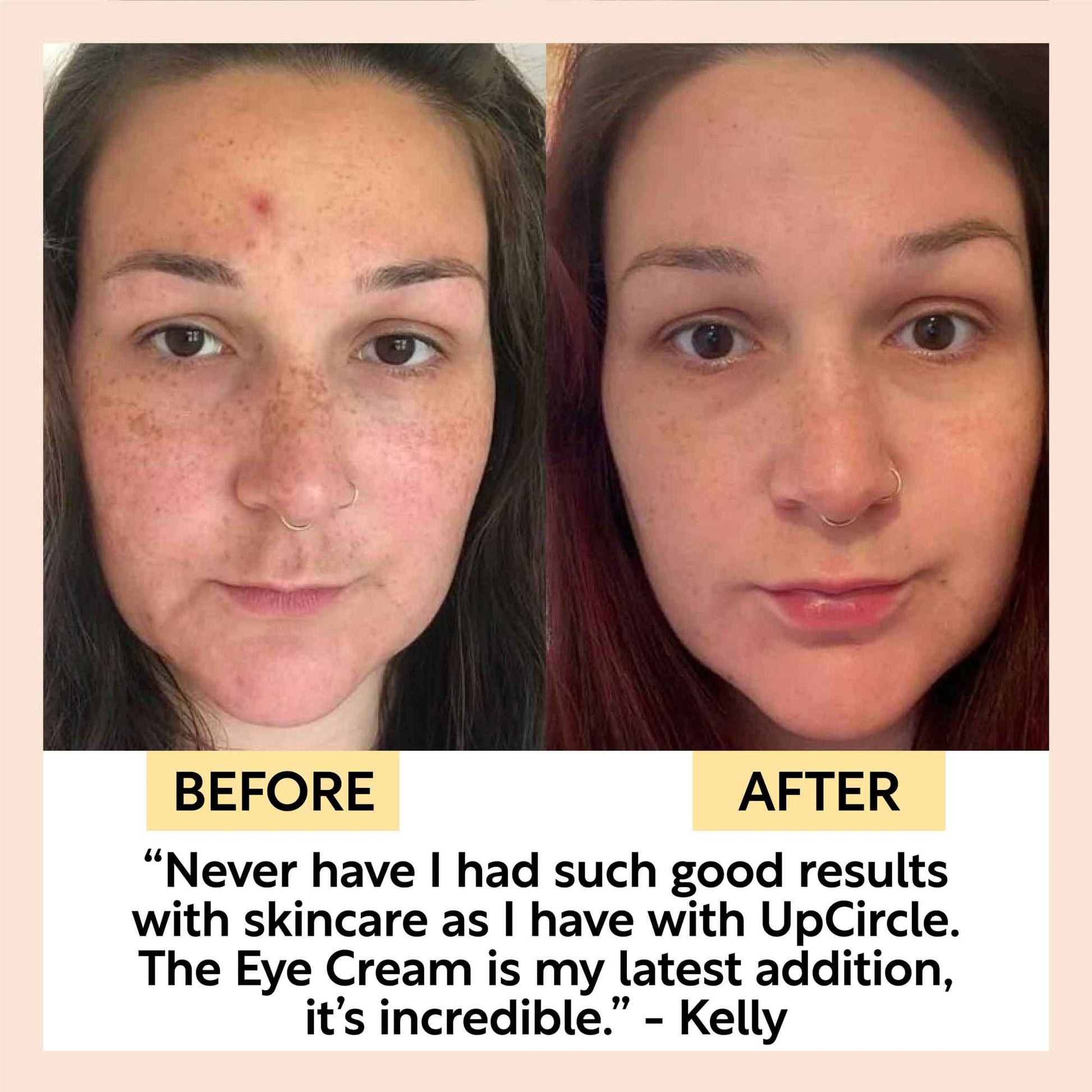Eye Cream with Hyaluronic Acid & Coffee - Korvel