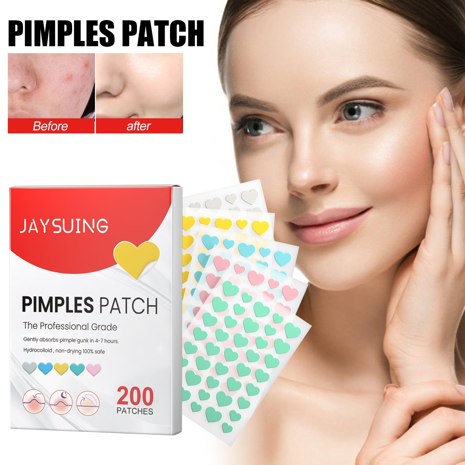 Pimples Patch, Mild Non-Irritant Lightening Pimples Spot Pimples Mark Covering Acne Pimples Patch - Korvel