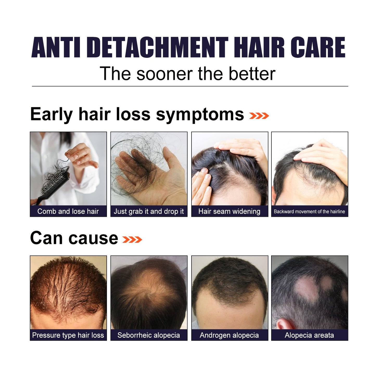 Herbal Hair Essence, Moisturizes Scalp Strong Hair Roots Thick Beard Care Essence - Korvel