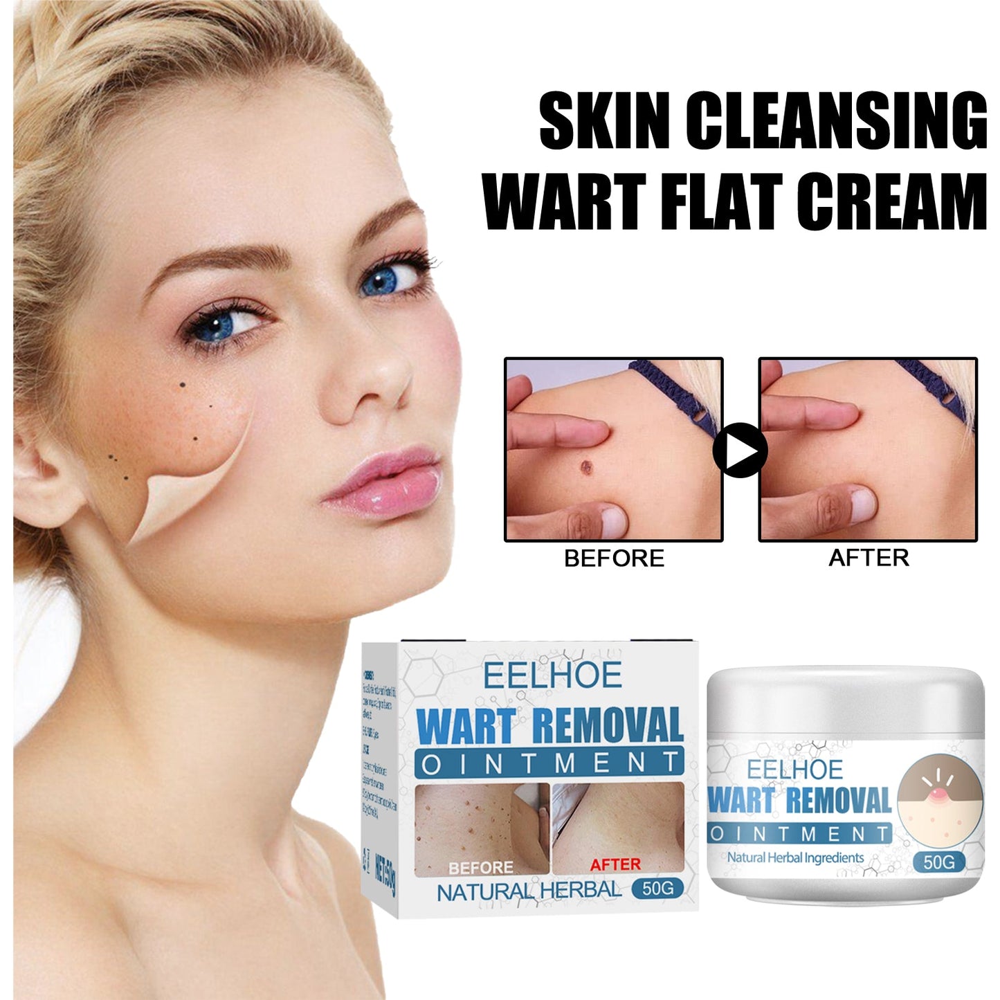 Crème Premium pour Verrues pour un Soin de la Peau Lisse