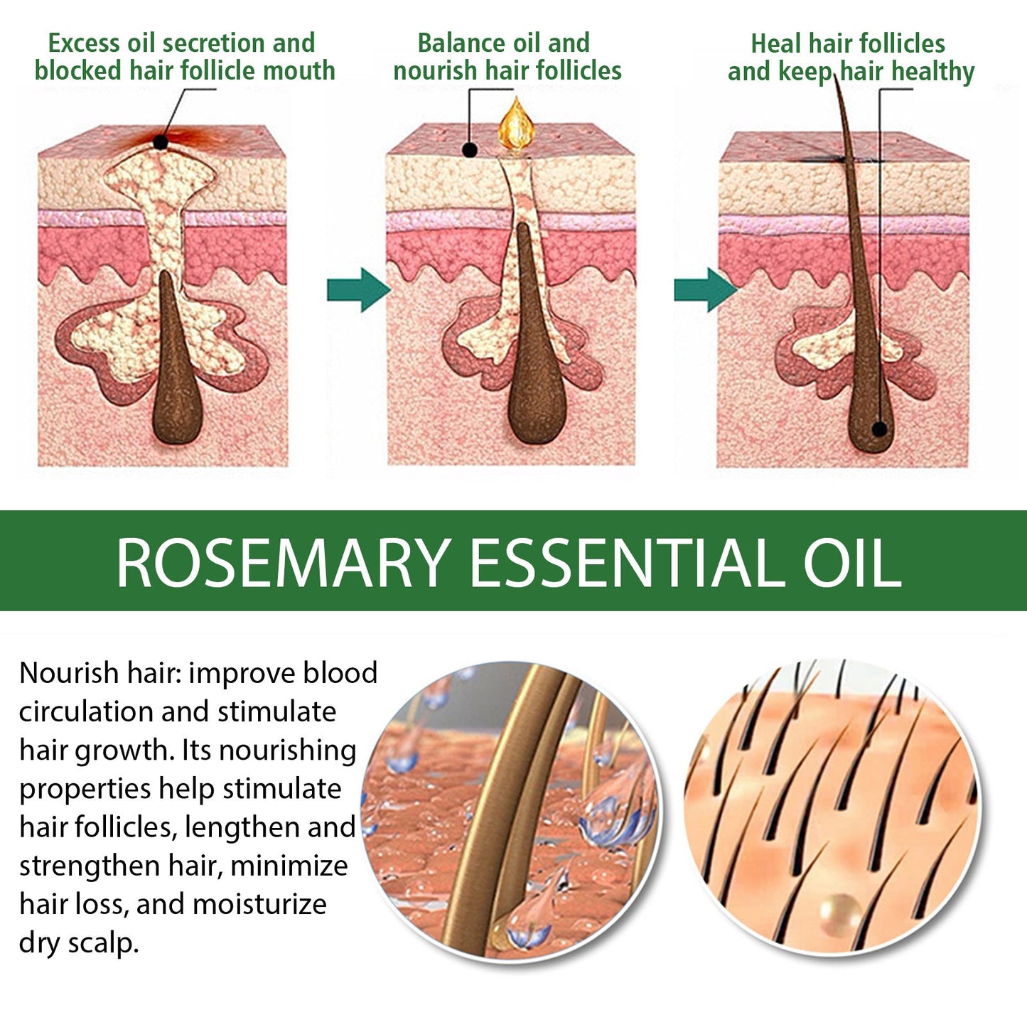 Multi-Effect Rosemary Essential Oil, Strengthens Hair Moisturizes And Thickens Hair And Skin Care Multi-effect Essential Oil - Korvel