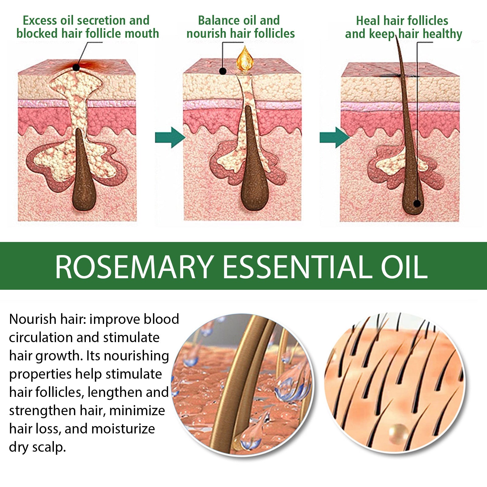 Multi-Effect Rosemary Essential Oil, Strengthens Hair Moisturizes And Thickens Hair And Skin Care Multi-effect Essential Oil - Korvel
