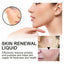 Skin Renewal Liquid, Reduce Acne Print Repair Acne Muscle Mild Clear Acne Hydrating Essence - Korvel
