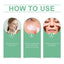 Azelaic Acid Essence Cream, Repair Moisturizing Moisturizing Face Oil Control Moisturizing Mild Refreshing Cream - Korvel